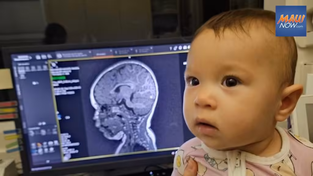 $3.3M National Institutes of Health grant funds UH study of microplastics, infant brain development : Maui Now