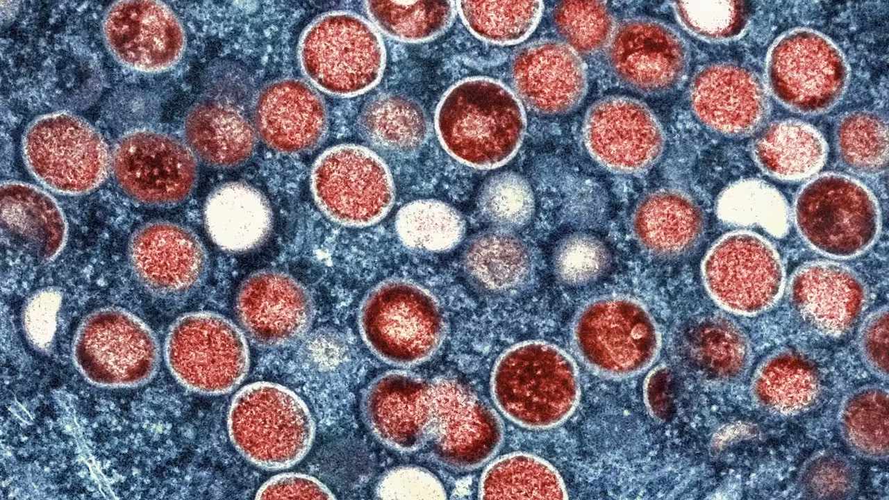 Hong Kong records 21 mpox cases since August, high-risk groups urged to get jabs