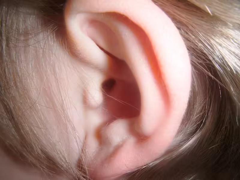 What if we treated hearing like any other metric of health? A seminar from the Cochlear Center