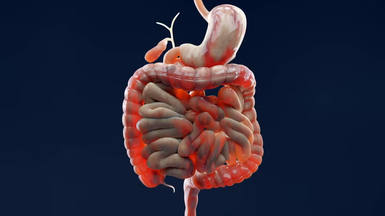 Why Does IBD Keep Flaring Up? Scientists Found a Clue in The Gut Lining : ScienceAlert